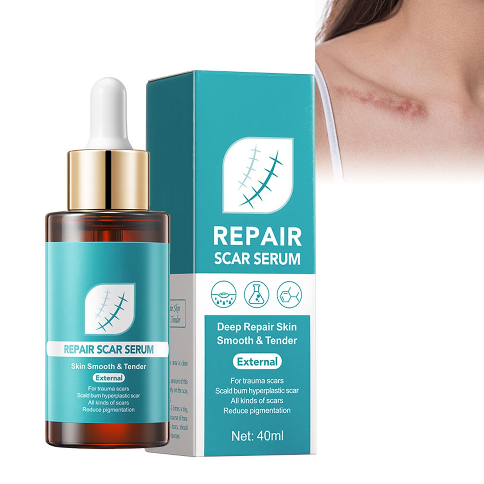 Serum do blizn, serum na blizny, serum na rozstępy, łagodniejsze blizny, bardziej elastyczne i mniej widoczne, stare i nowe blizny, usuwanie blizn