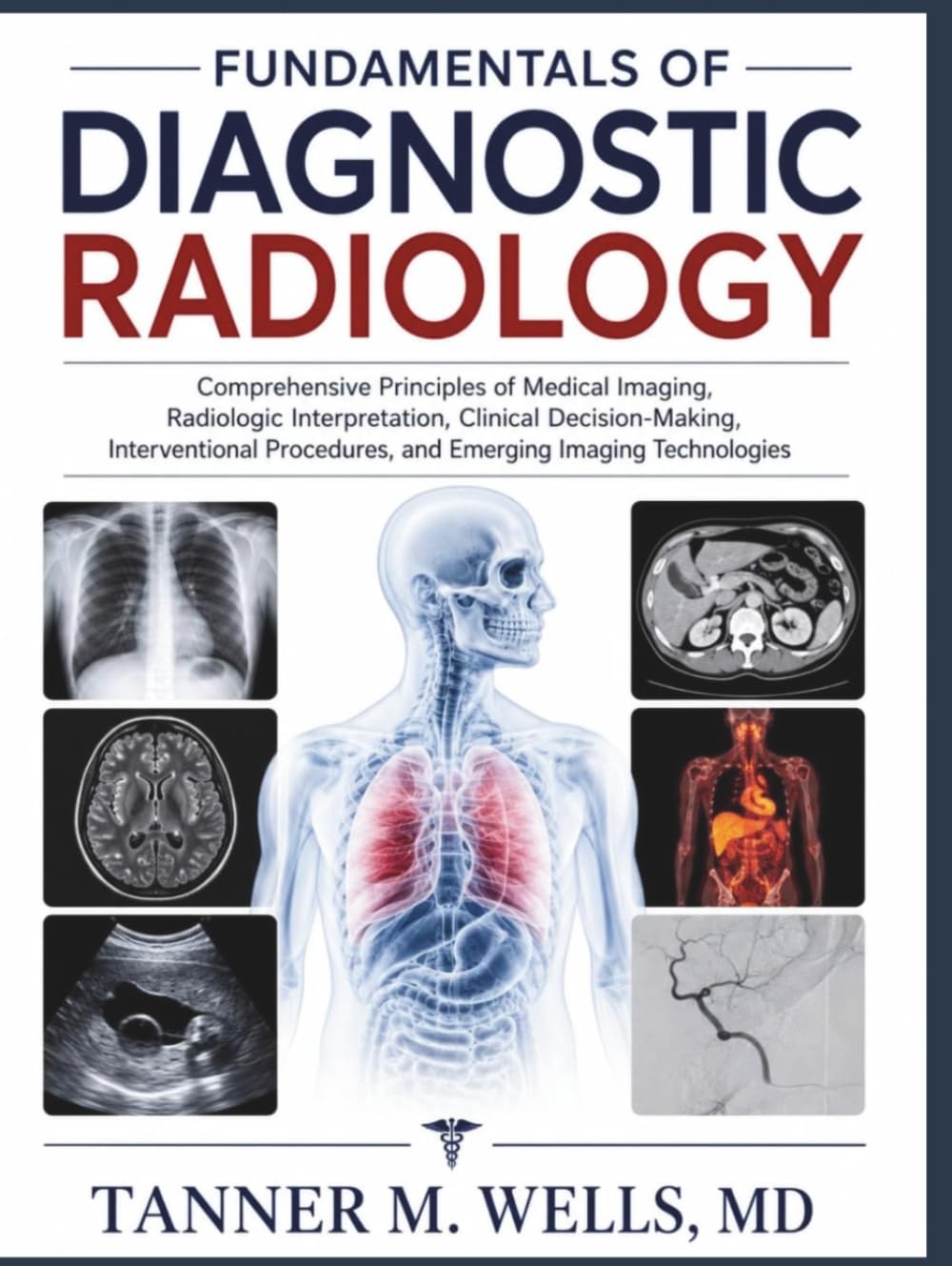 FUNDAMENTALS OF DIAGNOSTIC RADIOLOGY: Comprehensive Principles of Medical Imaging, Radiologic Interpretation, Clinical Decision-Making, Interventional Procedures, and Emerging Imaging Technologies