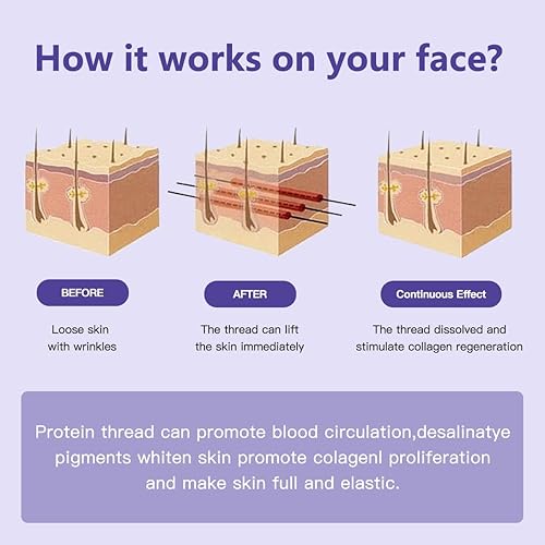 Miniatura 5 de Hilo Pdo (Cog 3D Sharp 19G 3.937in) para levantamiento facial, hilo de púas 360R cuerpo entero mandíbula elevación Pdo Sharp 3.937in rosca (10