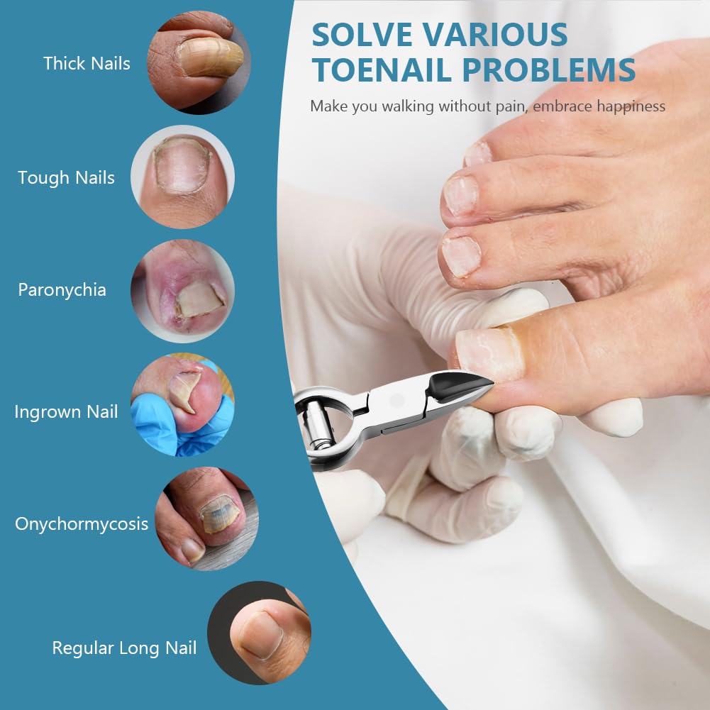 Beugo Pince Coupe Ongles, Coupe-Ongle pour Ongle Incarné et Épais Ciseaux Ongles Pieds en Acier Inoxydable Incarnés Robustes pour Mains et Pieds Manucure Pédicure
