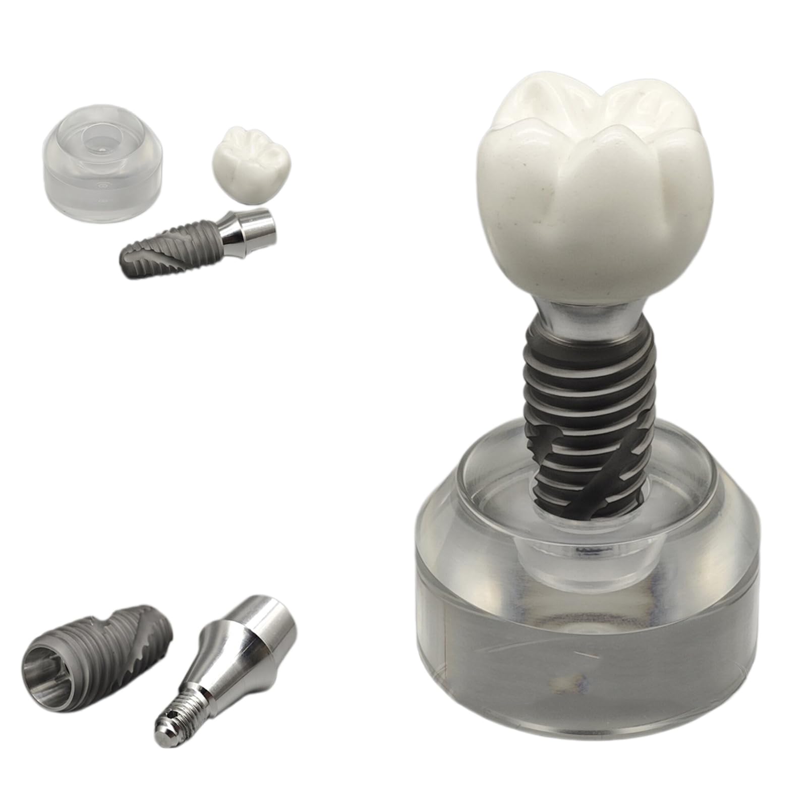 YRQMGSF Crystal Implant Model Dental and Oral Teaching Demonstration Model Clear Teeth for Study Teach