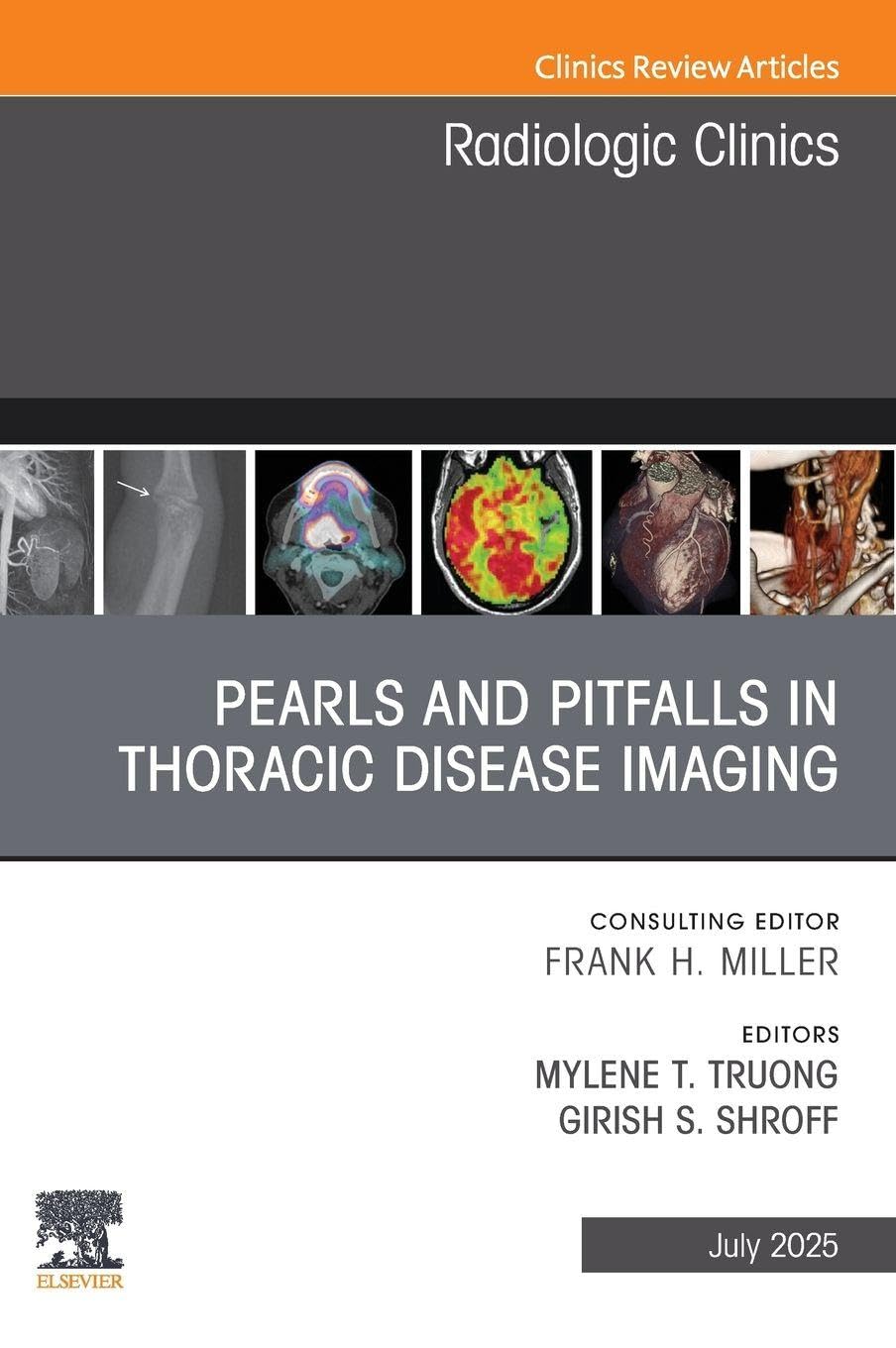 Pearls and Pitfalls in Thoracic Disease Imaging, An Issue of Radiologic Clinics of North America: Volume 63-4 (The Clinics: Radiology, Volume 63-4)