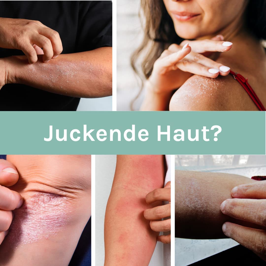 benevi ISO-Intensivcreme 75 ml mit Magnesium und Urea für trockene juckende schuppende Haut - auch als Basispflege bei Altershaut und zu Neurodermitis oder Schuppenflechte neigender Haut