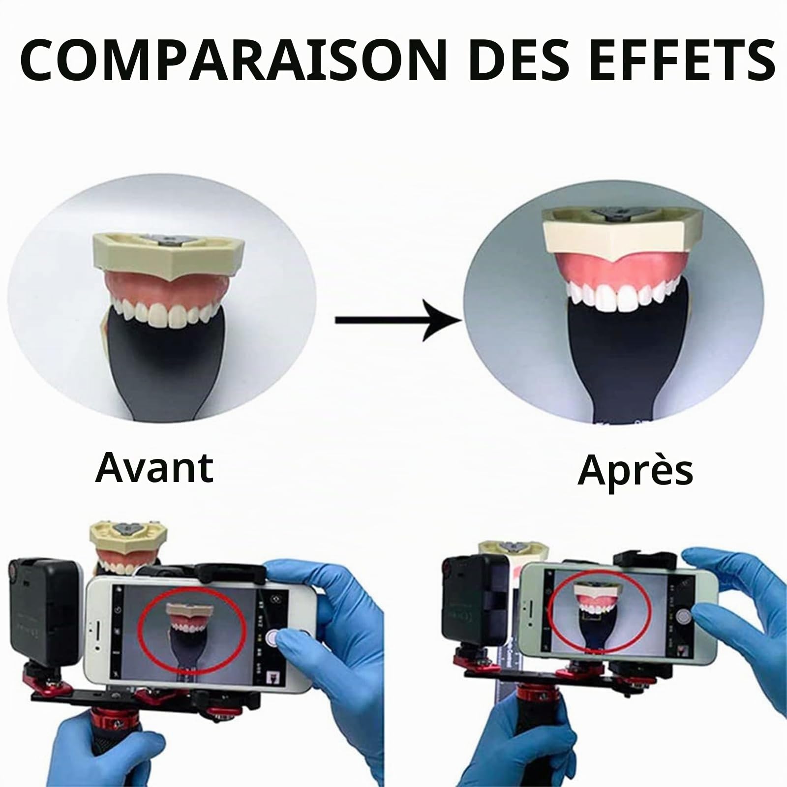 Aide à la Photographie Dentaire, lumière de Remplissage for Appareil Photo de téléphone Portable Dentaire avec Angle réglable à 360 °, kit d'éclairage de Studio de lumière vidéo LED