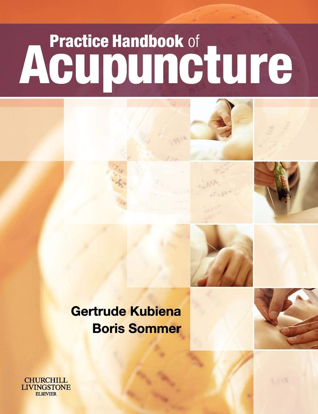 Practice Handbook of Acupuncture Kubiena Sommer Paperback Churchill Livingstone