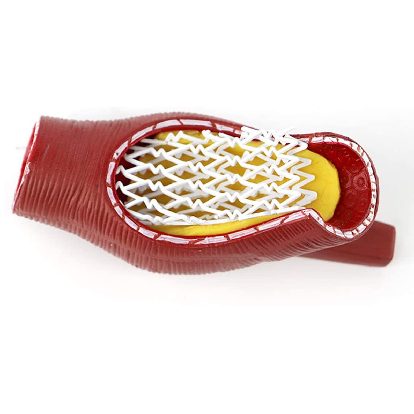 Modello di Blocco dei vasi sanguigni del Cuore e del Cervello Umano, Modello anatomico dello Stent del Corpo Umano per la dimostrazione di Modelli di Anatomia scientifica