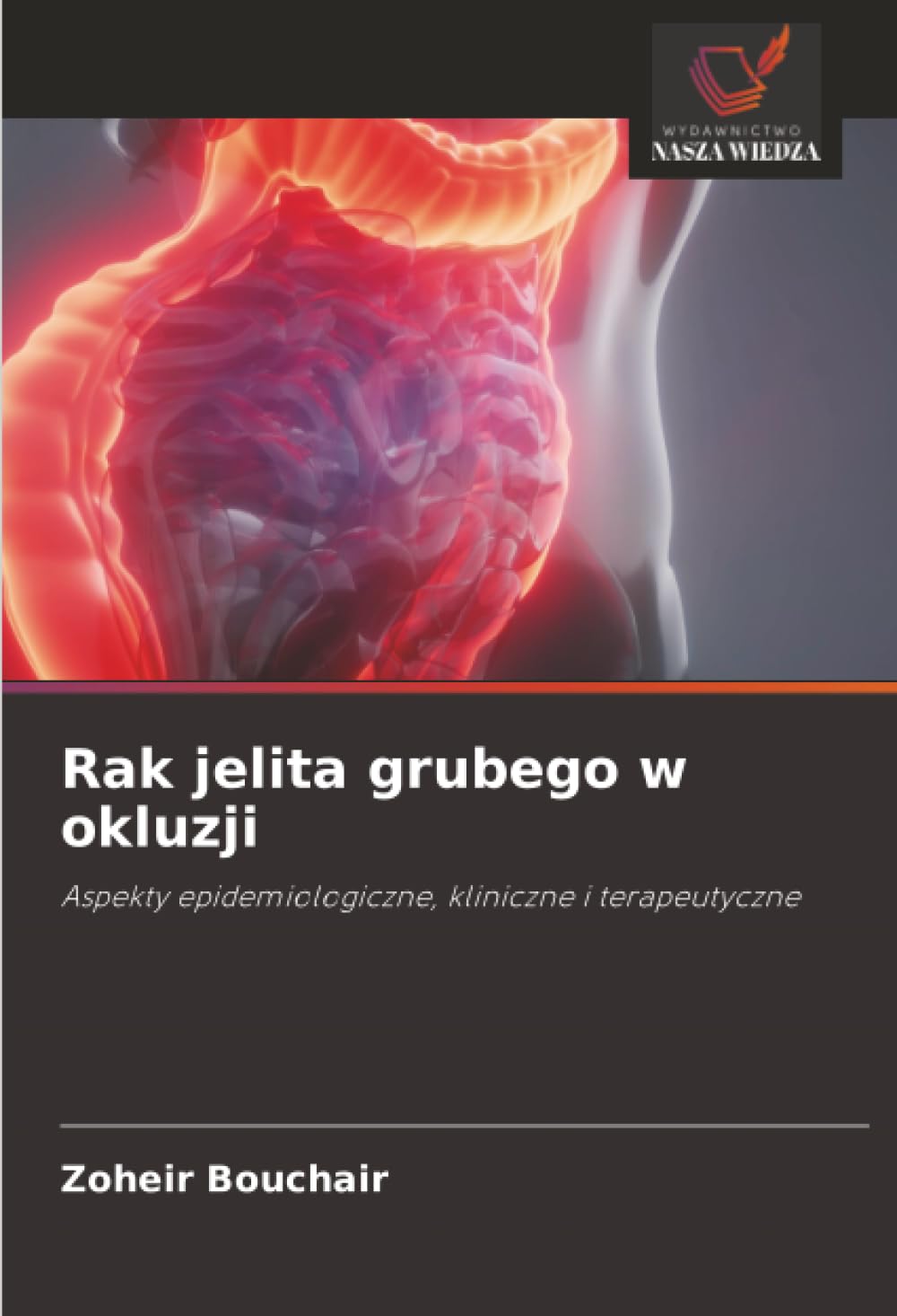 Rak jelita grubego w okluzji: Aspekty epidemiologiczne, kliniczne i terapeutyczne