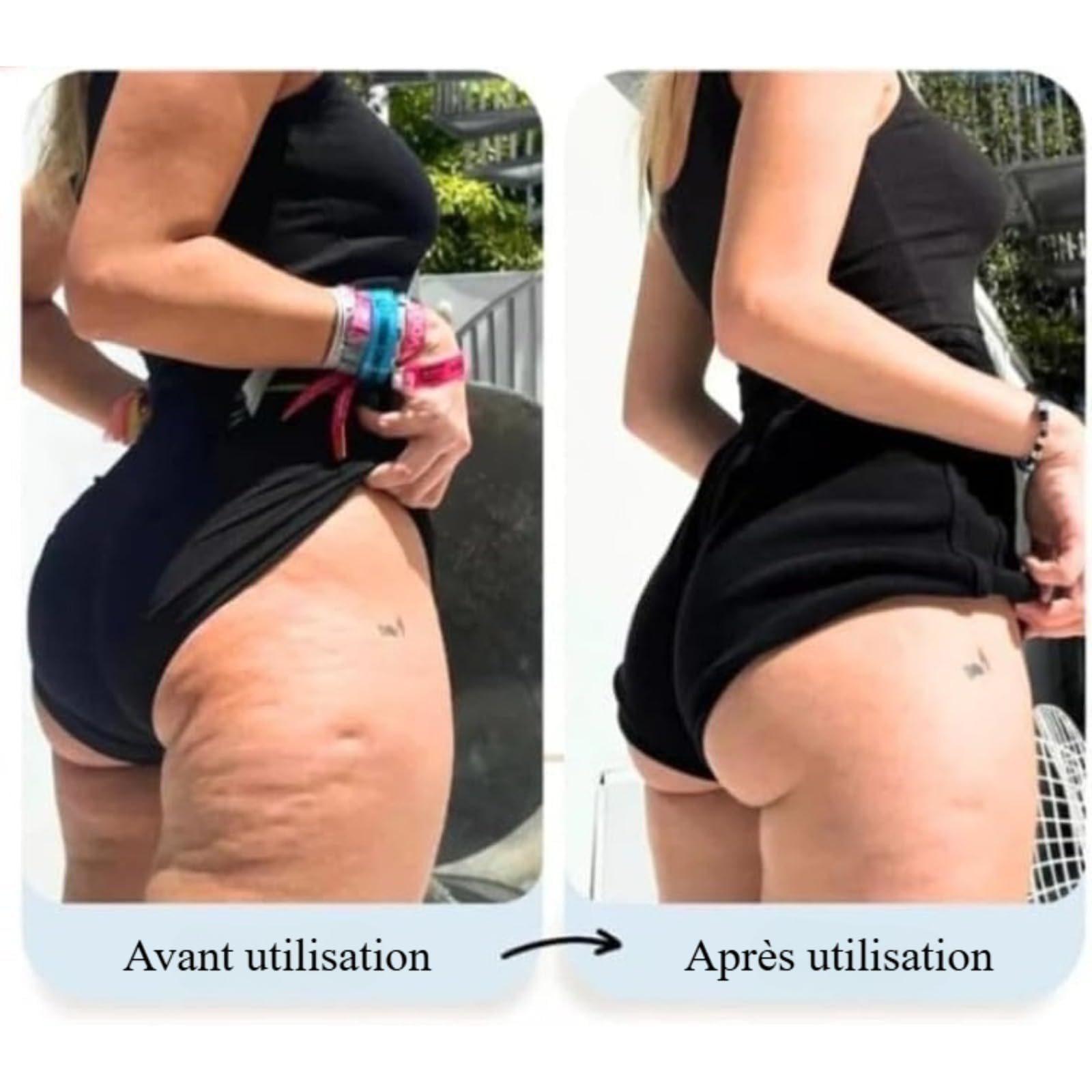 Vacuvia SculptGlow, Appareil anti-cellulite 4-en-1, massage par vide et chaleur, corps (Vacuvia Pro)