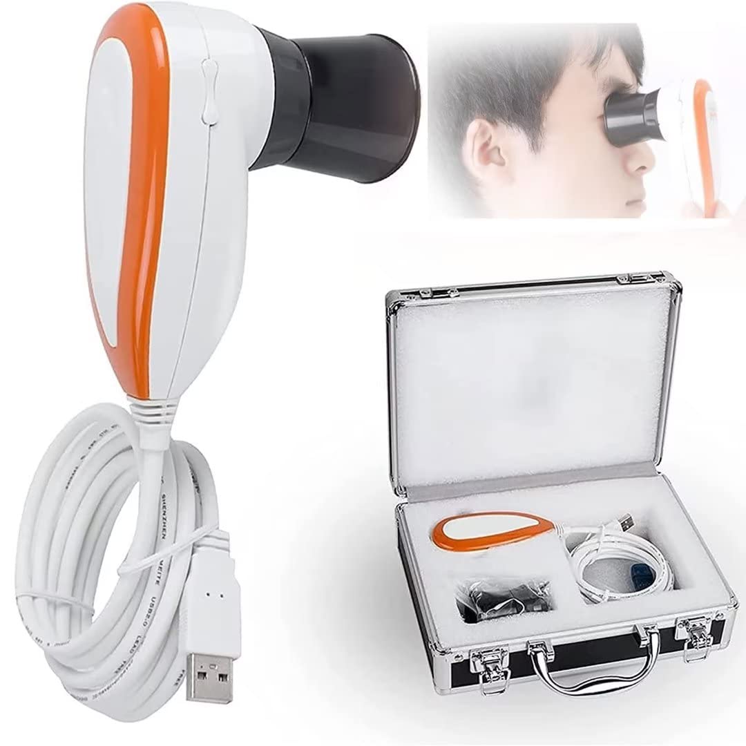 Amazon.co.jp: 虹彩分析カメラ、虹彩診断眼科カメラ、500万画素の 2560