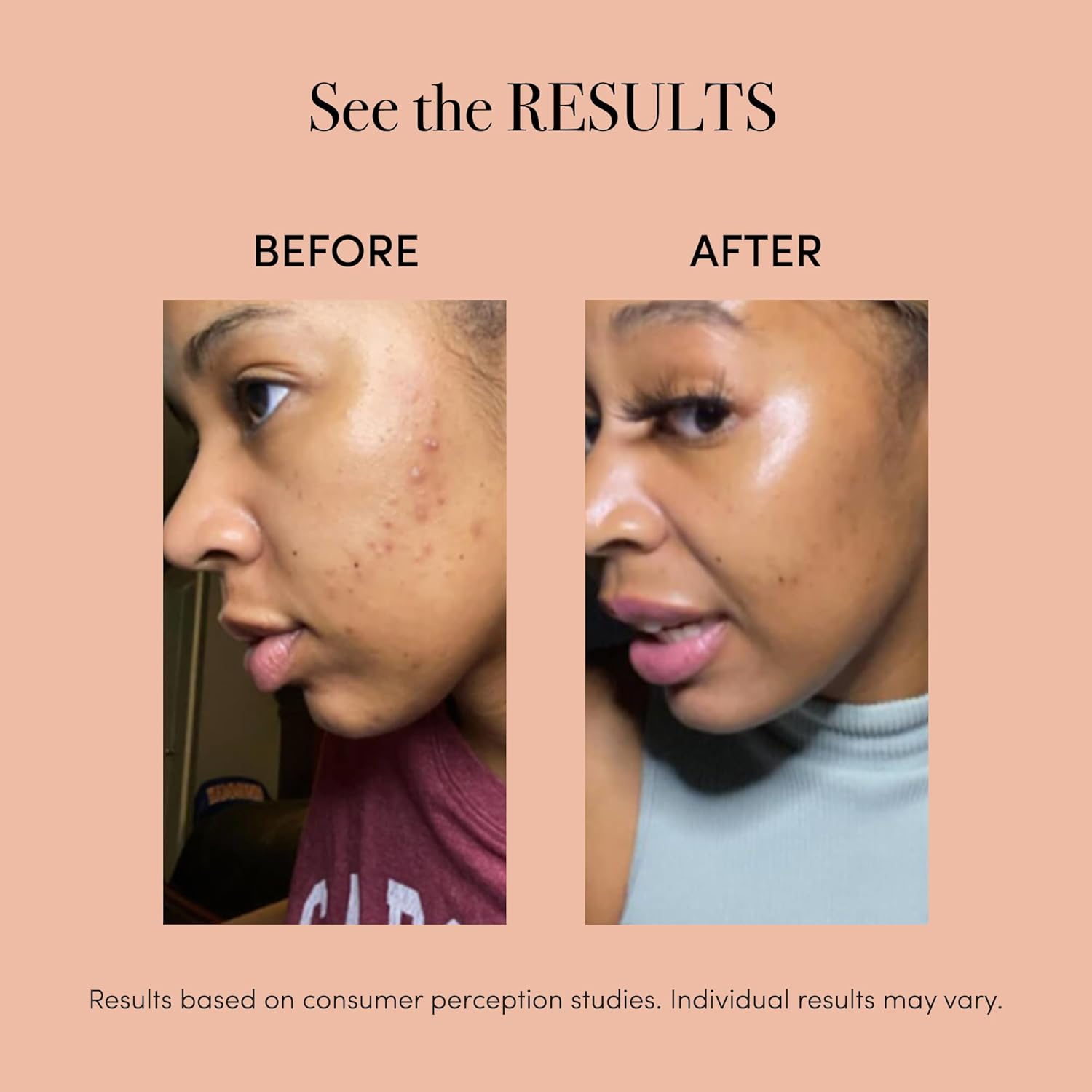 reVive Light Therapy Lux Collection Spot Acne Device, Portable Red & Blue Light LED Therapy Products for Blemish-Prone Skin, Rechargeable, On-The-Go Face Tools for Skincare, Black - Image 3