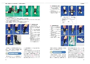 実践足の保存療法 : 手術の前にすべきこと 実践 足の保存療法: 手術の前にすべきこと | 熊井 司 |本 | 通販