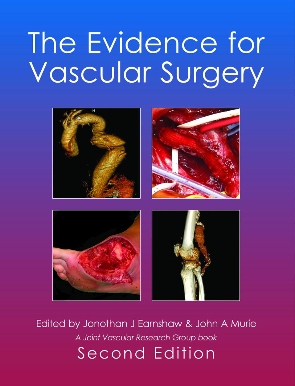 The Evidence for Vascular Surgery: 2nd Edition