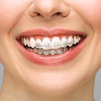 Vista 7 de BVN Cera dental: 10 cajas de tiras de cera de ortodoncia, cera de frenillos para dientes, cera ortográfica para aparatos ortopédicos, cera dental