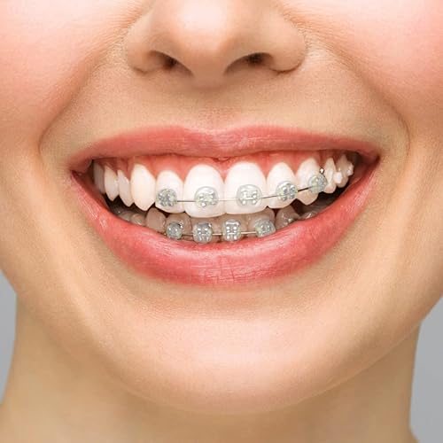 Miniatura 7 de BVN Cera dental 20 cajas de tiras de cera de ortodoncia, cera de frenillos para dientes, cera ortográfica para aparatos ortopédicos, cera dental,