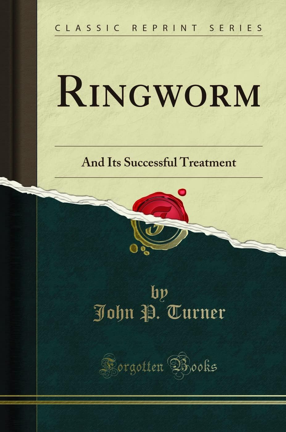 Ringworm: And Its Successful Treatment (Classic Reprint) Paperback – 19 April 2018