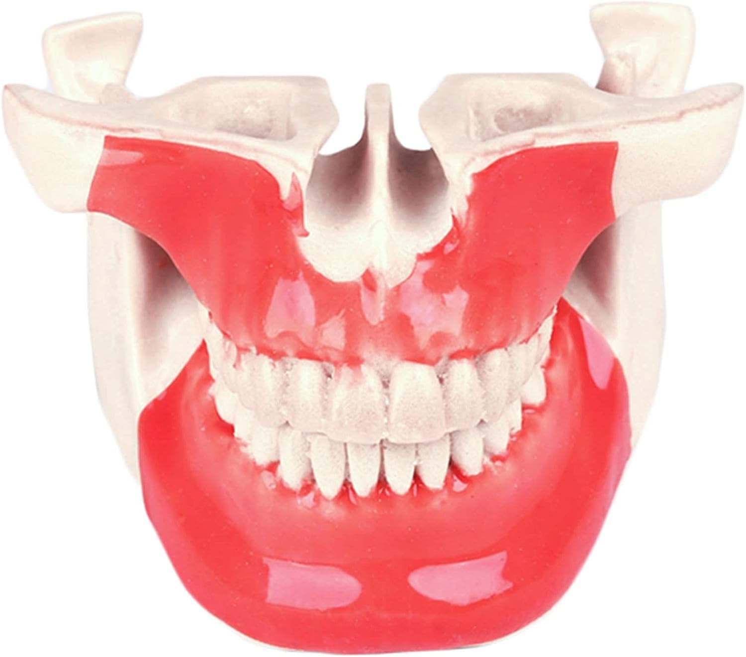 Model zęba Choroba implantu dentystycznego Model zębów Student Materiał żywiczny Zestaw do nauczania ustnego