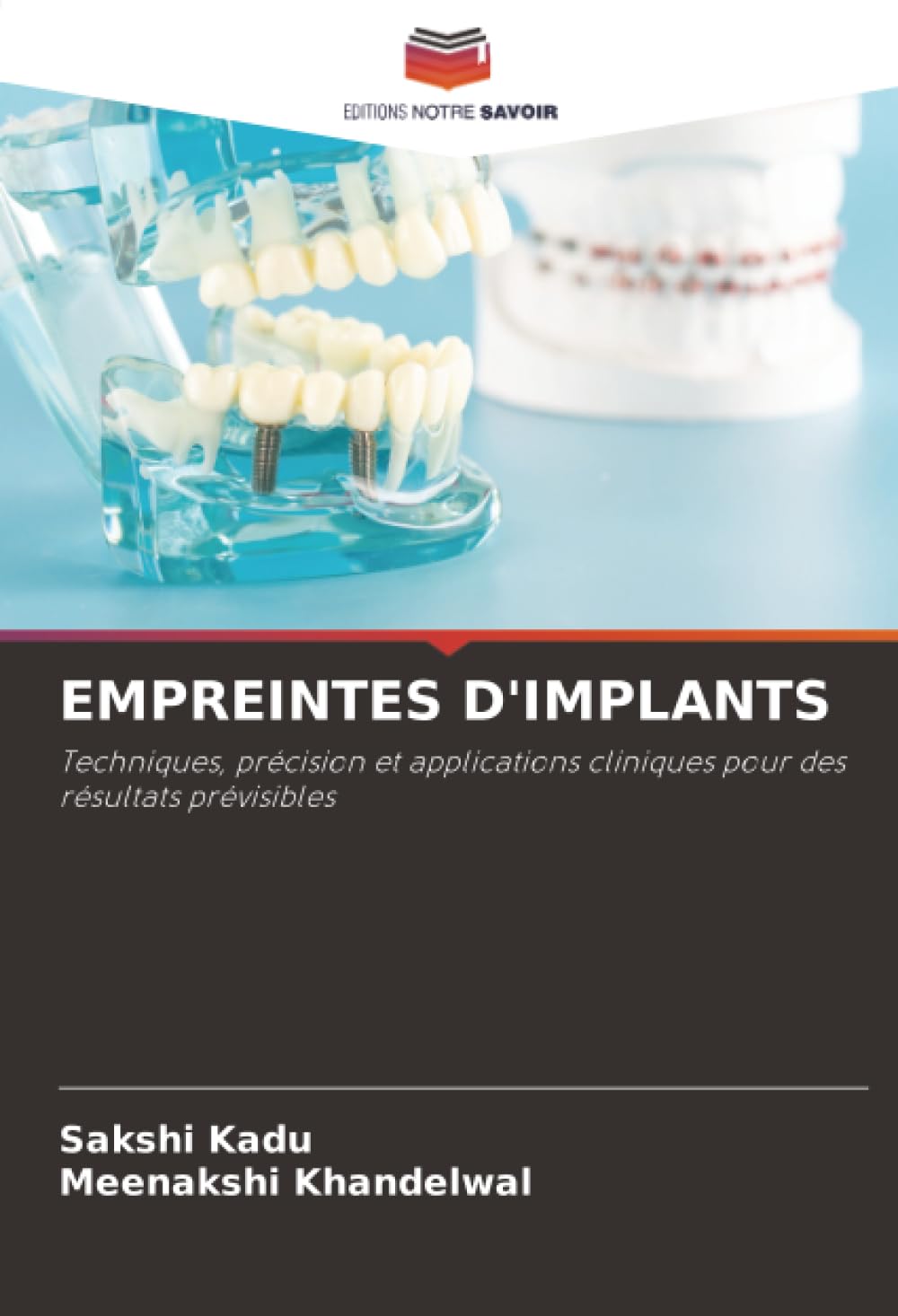 EMPREINTES D'IMPLANTS: Techniques, précision et applications cliniques pour des résultats prévisibles