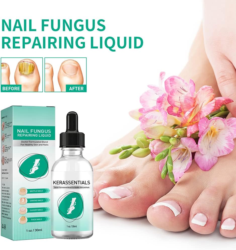 KLEOAD Toenail Fungus Treatment Oil, Healthy Skin, Nail Fungus Removal Liquid Natural Toenail Fungus Oil Nail Care Nail Treatment, May Support Strong Healthy Natural Nails, Healthy Skin : Health & Household