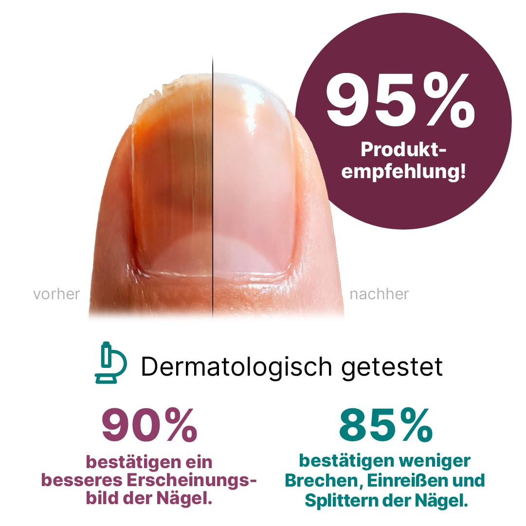Nagelserum von CT 8ml - Nagelpflege bei verfärbten, verdickten Nägeln – mit 8% Ciclopirox – Wasserlöslicher Nagellack mit Chitosan (HPCH) – Regeneriert brüchige Nägel mit Silicium & MSM - PZN 19902455