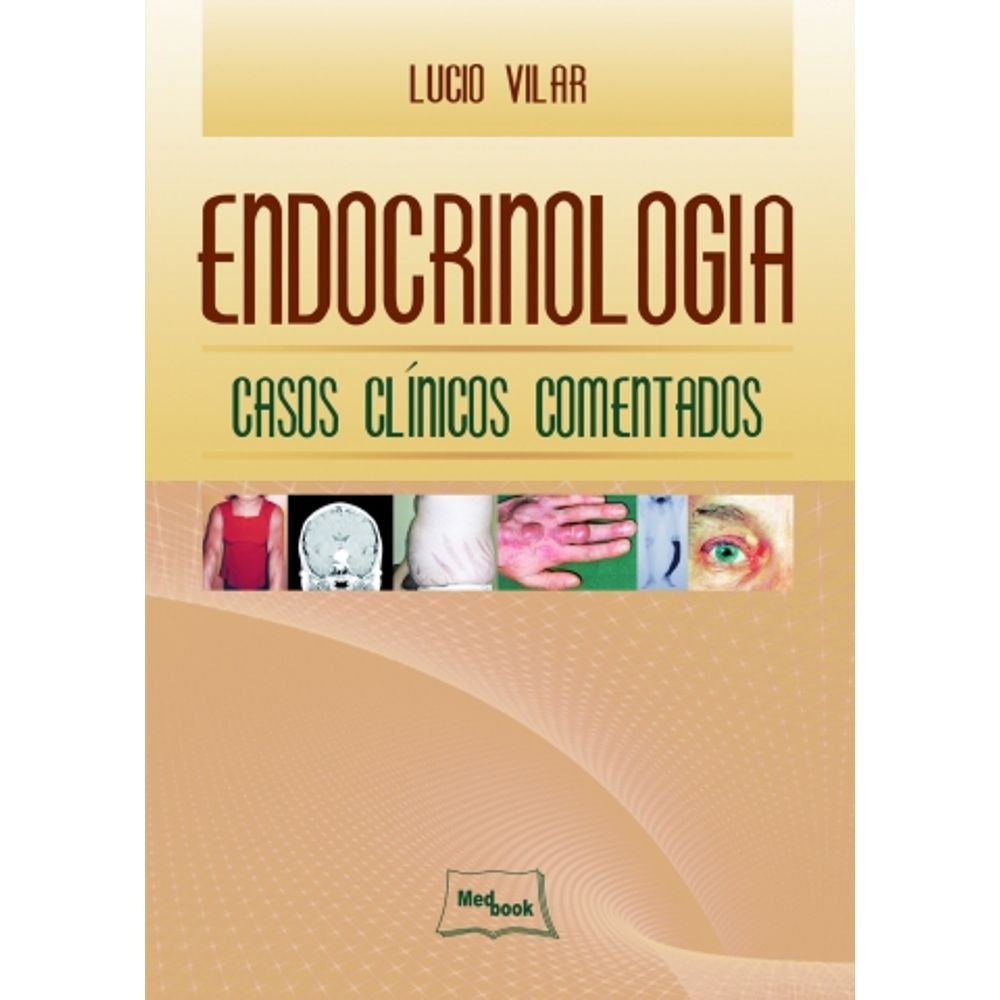 Endocrinologia. Casos Clínicos Comentados