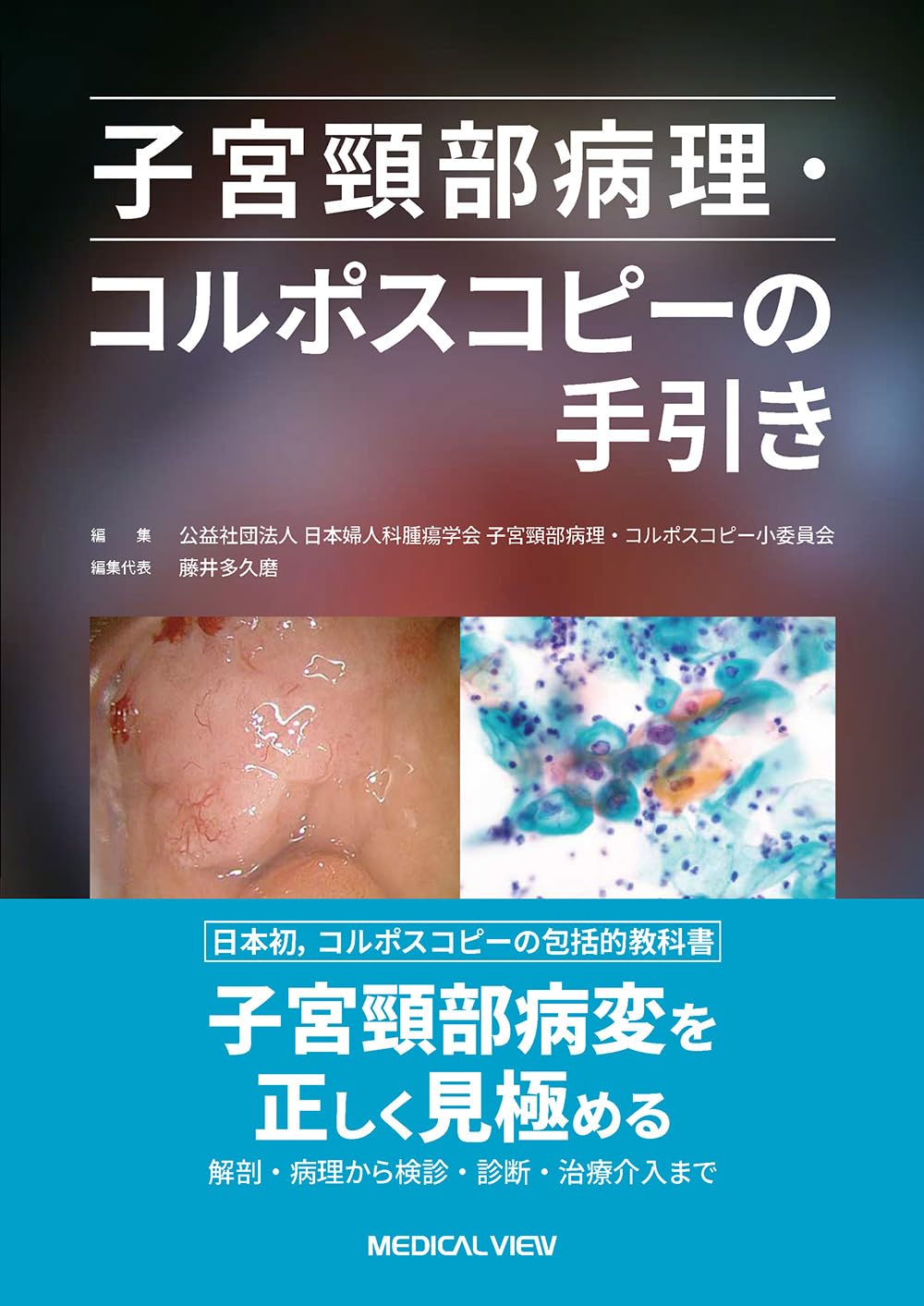 子宮頸部病理・コルポスコピーの手引き | 日本婦人科腫瘍学会 子宮頸部