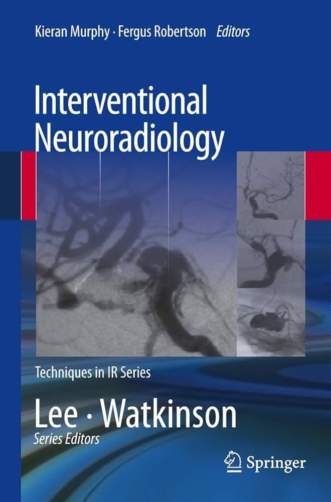 健康・医学 Interventional Neuroradiology Interventional Neuroradiology – Los Angeles, CA | Cedars-Sinai