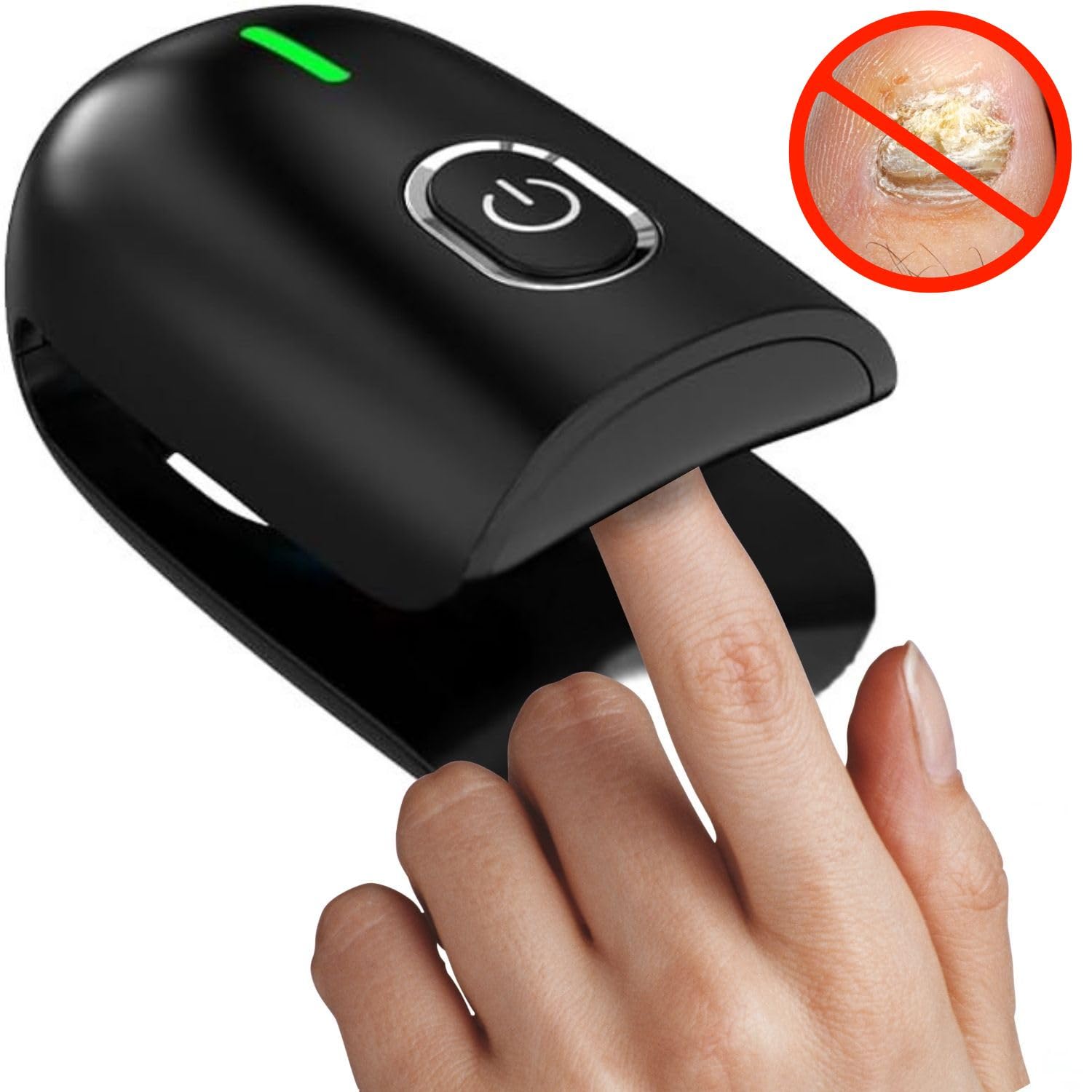 Tratamiento hongos uñas pies - Tratamiento Laser onicomicosis - antihongos - antifungico para uñas pies y manos - Eliminar micosis - potente tratamiento anti hongos - Quita hongos (Negro)