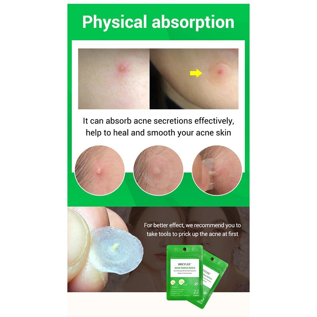 T.O.G. ACNE DOT Spot Treatment - Clear Zit Blemish Oily Skin Pimple Patch