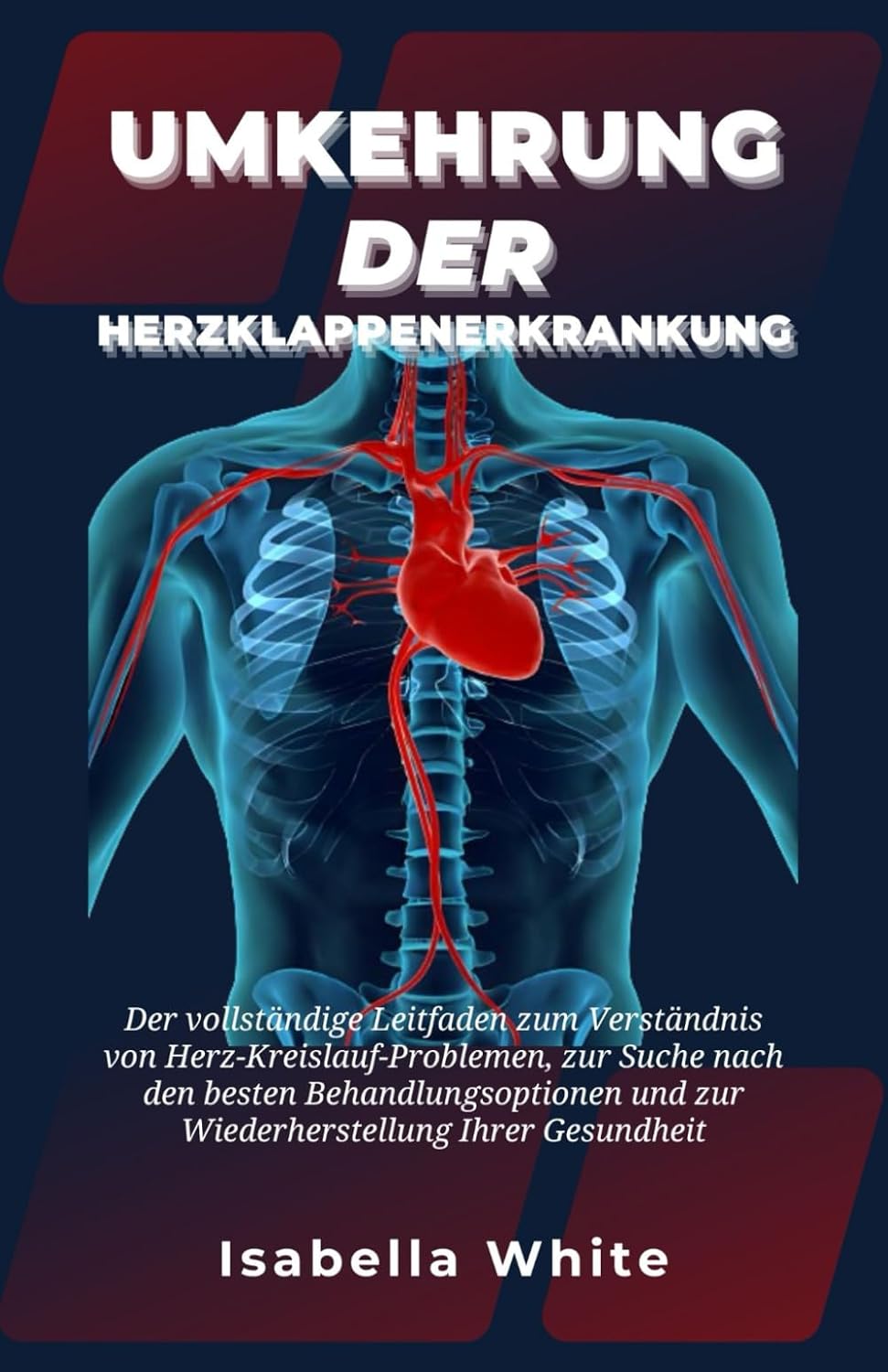 Umkehrung der Herzklappenerkrankung: Der vollständige Leitfaden zum Verständnis von Herz-Kreislauf-Problemen, zur Suche nach den besten Behandlungsoptionen und zur Wiederherstellung Ihrer Gesundheit
