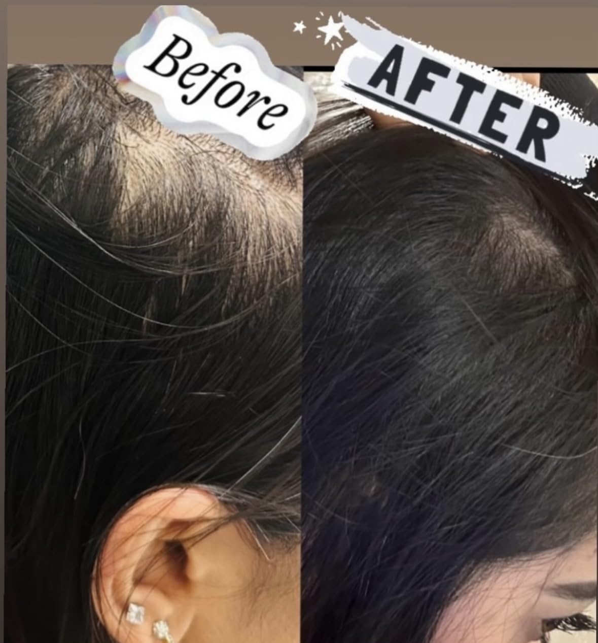 Scalp Treatment for Hair Fall Prevention, Organic Herbal Formula, Repairs Damaged Hair, Silky Smooth Hair (8.45 FL Oz)