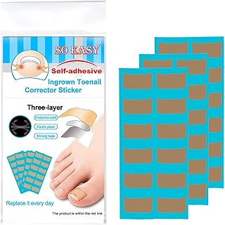 Mingzhe Kit de correção de unha encravada Adesivos de unha encravada Tratamento de alisamento Recuperador corretor de unha do dedo do pé Ferramenta de cuidado de unha