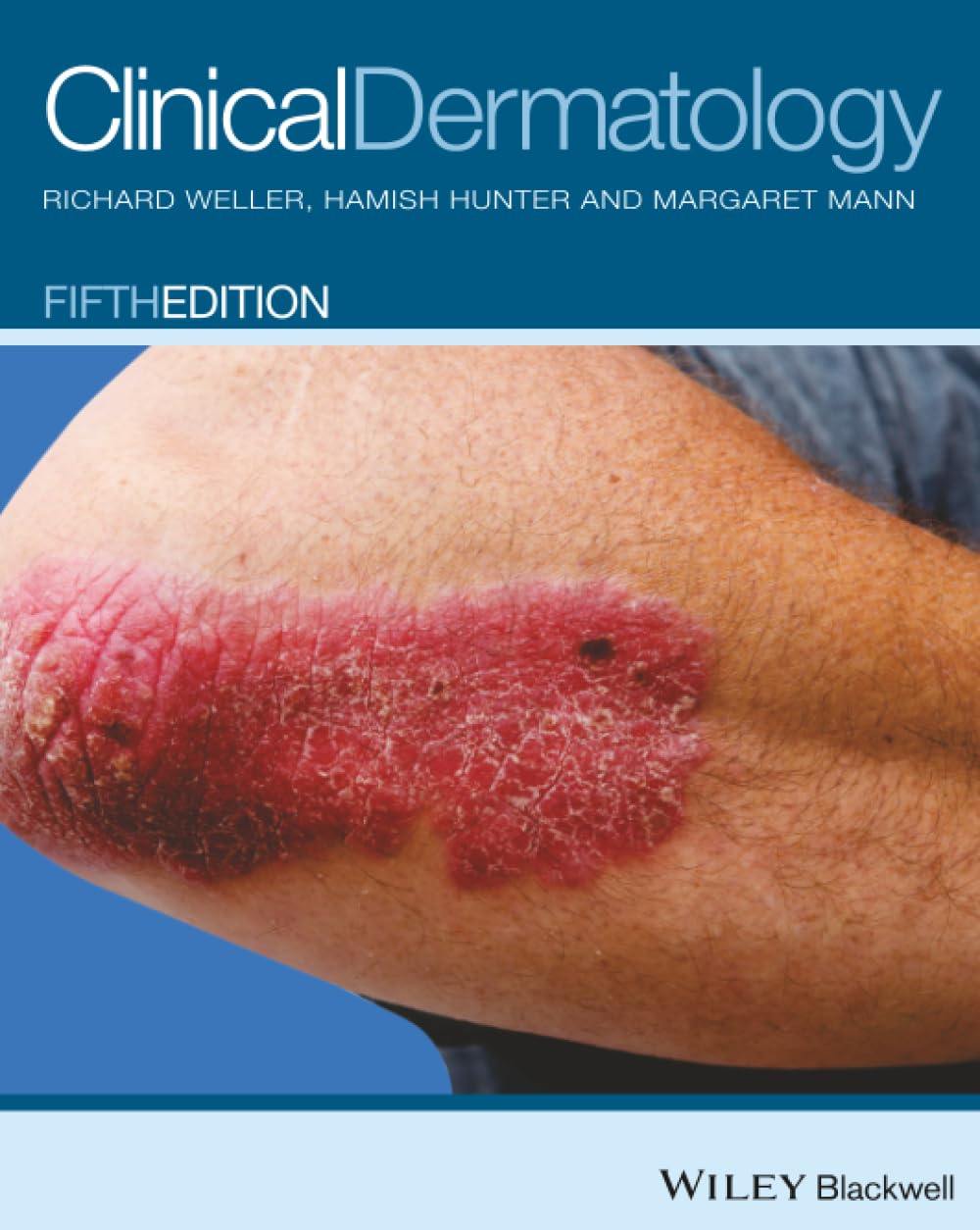 Clinical Dermatology, Weller, Hunter, Mann 9780470659526 Fast Free Shipp PB^+