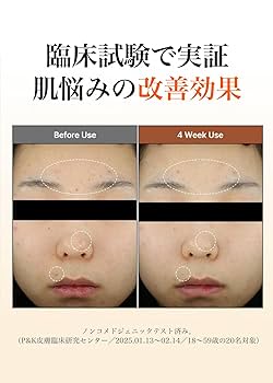 Amazon | 毛穴 化粧水 マンデル酸 5％ スキンプレップ