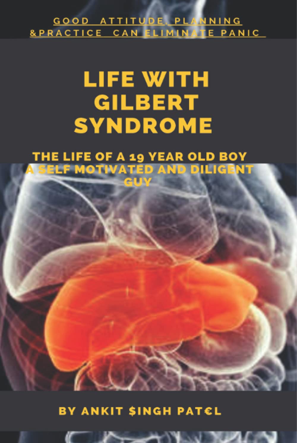 LIFE WITH GILBERT SYNDROME