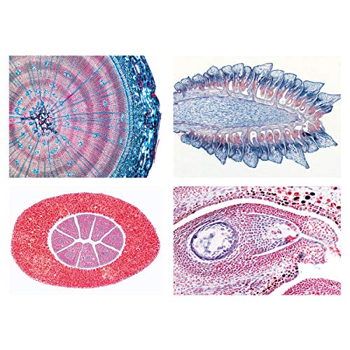 Image of 3B Scientific GmbH W13016F Angiospermae I. Gymnospermae -