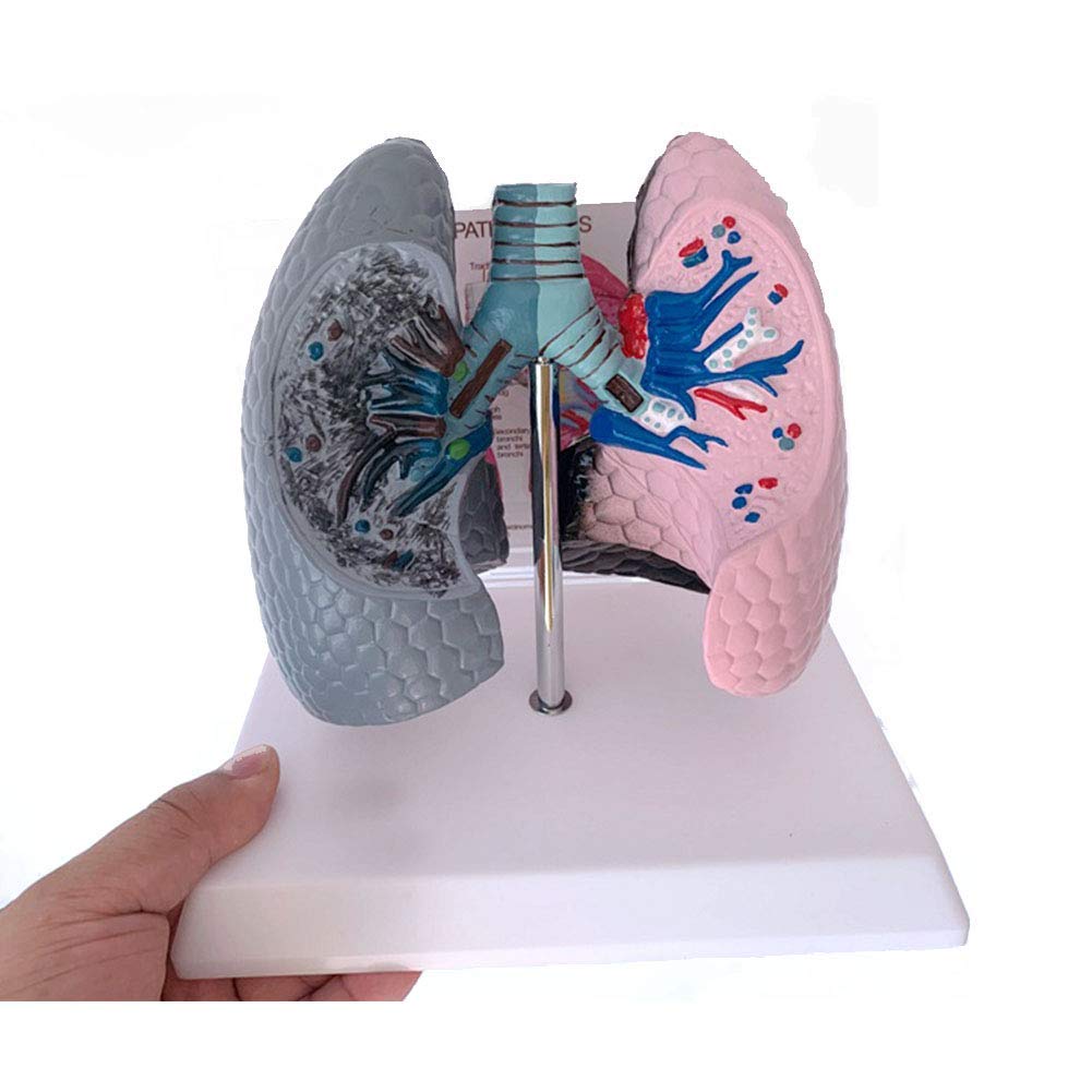 Sjdopulse Human Lung Model, Smoking Lung And Healthy Lung Model, Visceral Respiratory Pathology Comparison Demonstration