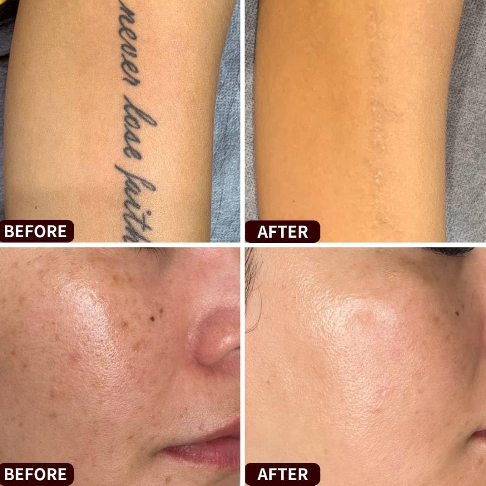 Red Pen for Women Lightweight — view 2