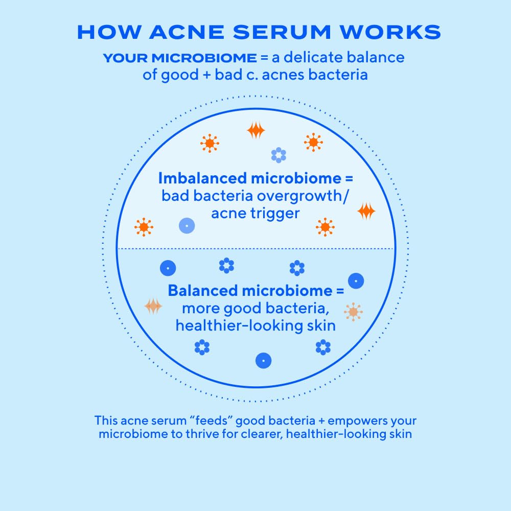 Murad Biome-Balancing Acne Treatment – Salicylic, Mandelic, and Glutamic Acid Serum for Clearing and Preventing Breakouts, Decongesting Pores, and Balancing Skin Microbiome – 1.0 Fl Oz