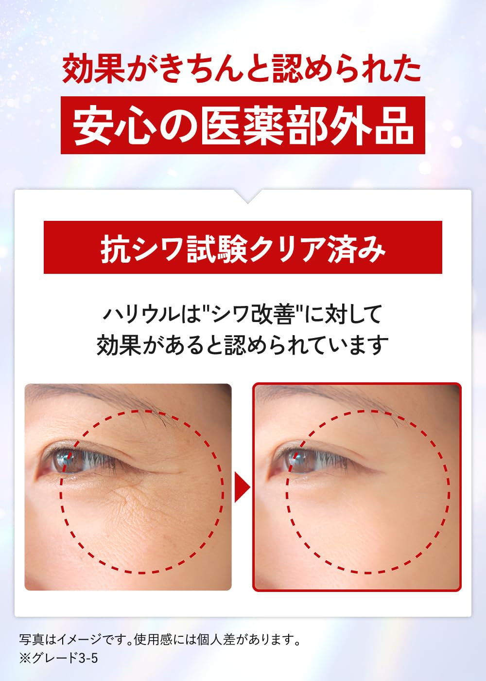 Amazon | シミ取り シワ改善 美白クリーム シミ消し ナイアシンアミド