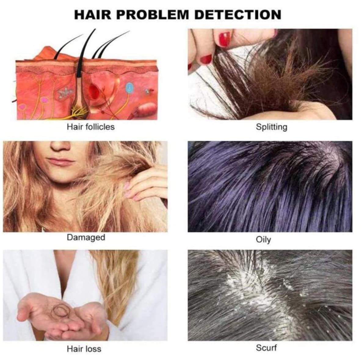 Analizzatore di Capelli per diagnosi della Pelle da 11 Pollici, Rilevatore Rilevatore Del Cuoio Rilevatore Di Microcamera Per Per Cuoio Capelluto Capillare