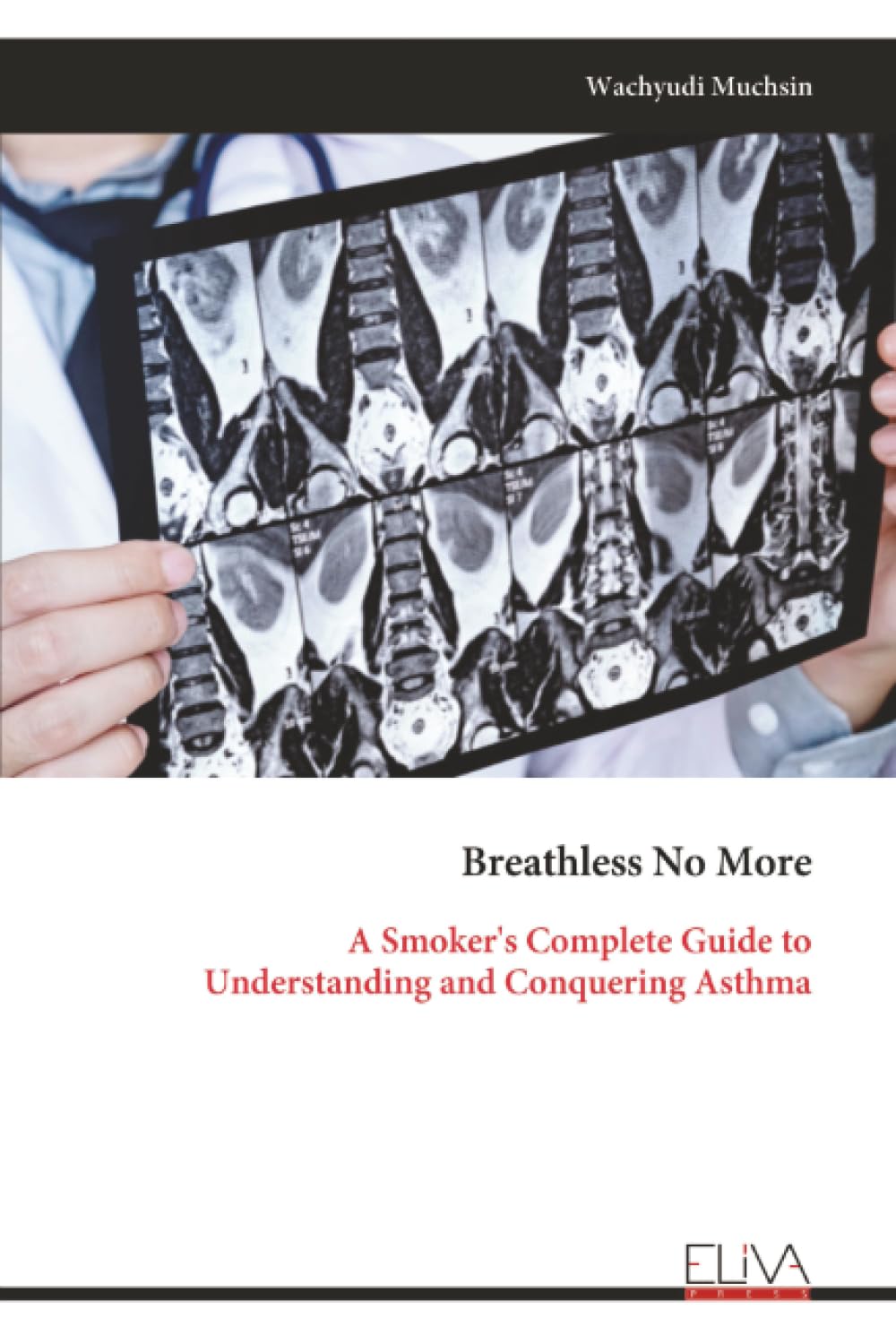 Breathless No More: A Smoker's Complete Guide to Understanding and Conquering Asthma