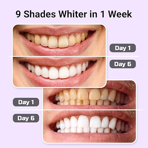 Miniatura 5 de Kit de blanqueamiento dental  Luz LED y gel blanqueador con jeringas de remineralización  Blanqueamiento de grado profesional para dientes sensibles