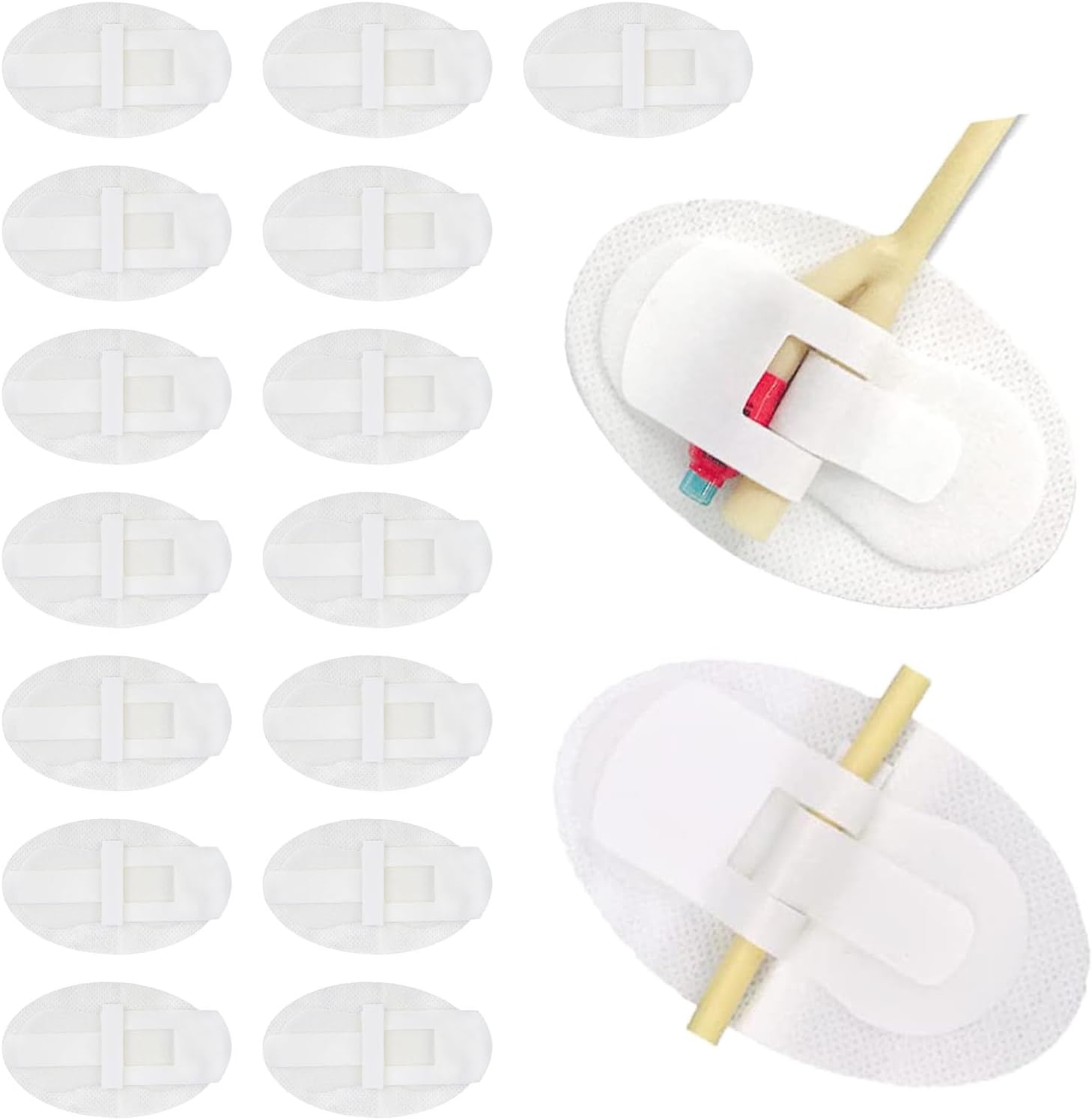 MATISU Catheter stabilization Device, Catheter Urinary Leg