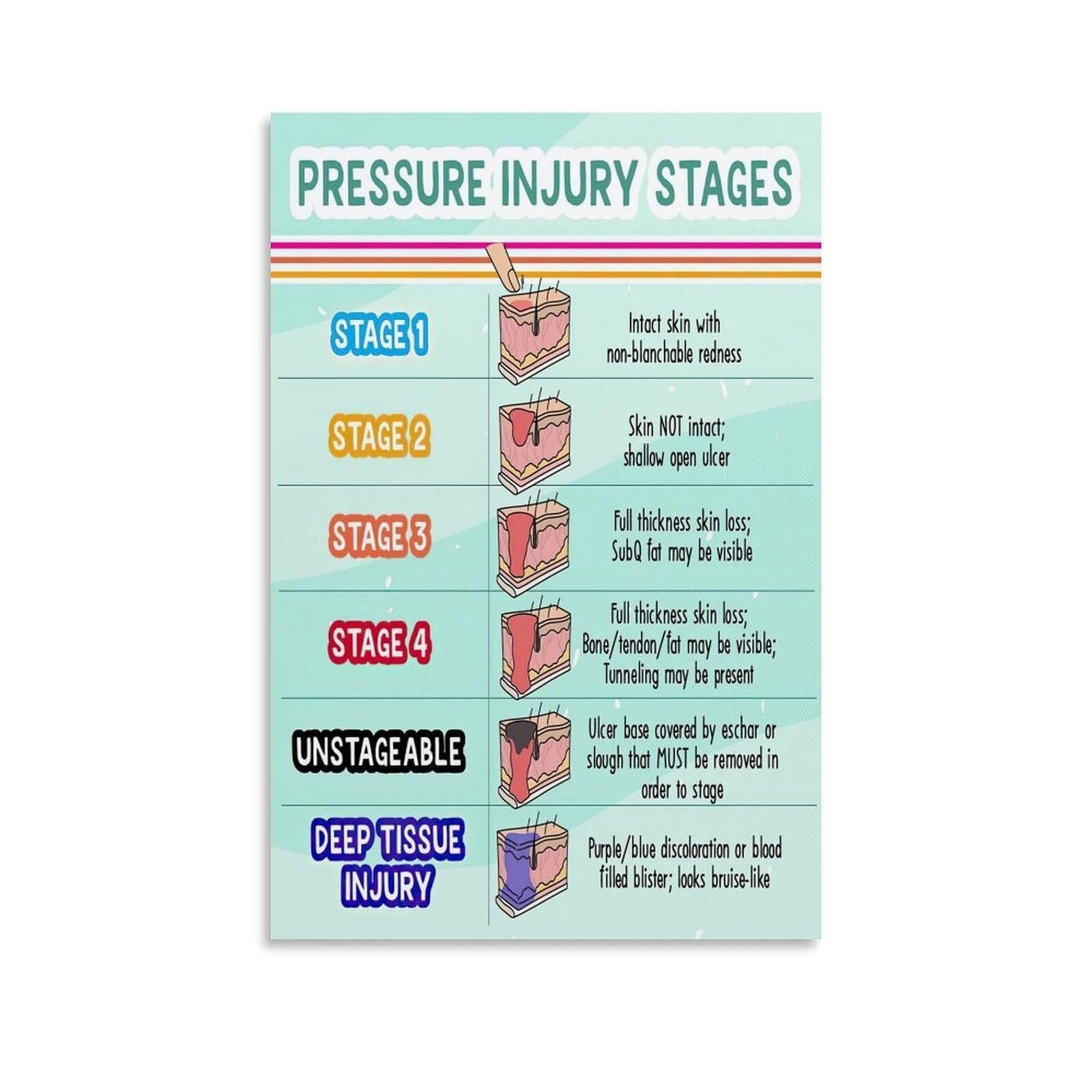 DQFOCPHHAA Pressure Injury (Pressure Ulcer) Stages Poster Comprehensive Nursing Reference Guide - Healthcare Educational Wall-Art for Office, Classroom, Nurse Gift(Framed,16x24inch(40x60cm))