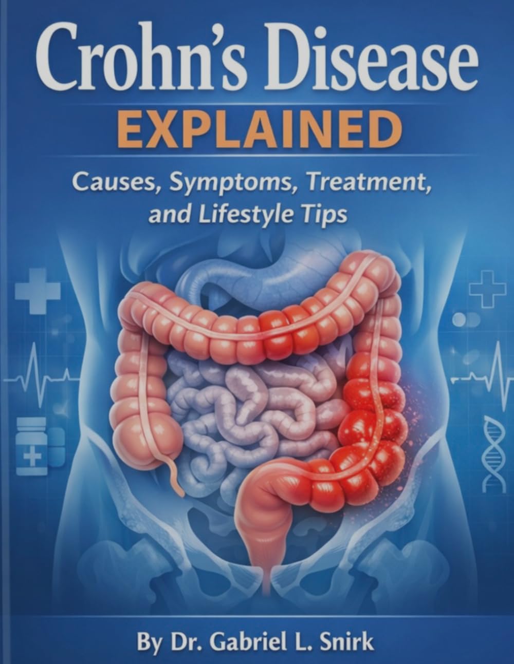 Crohn’s Disease Explained: Causes, Symptoms, Treatment, and Lifestyle Tips