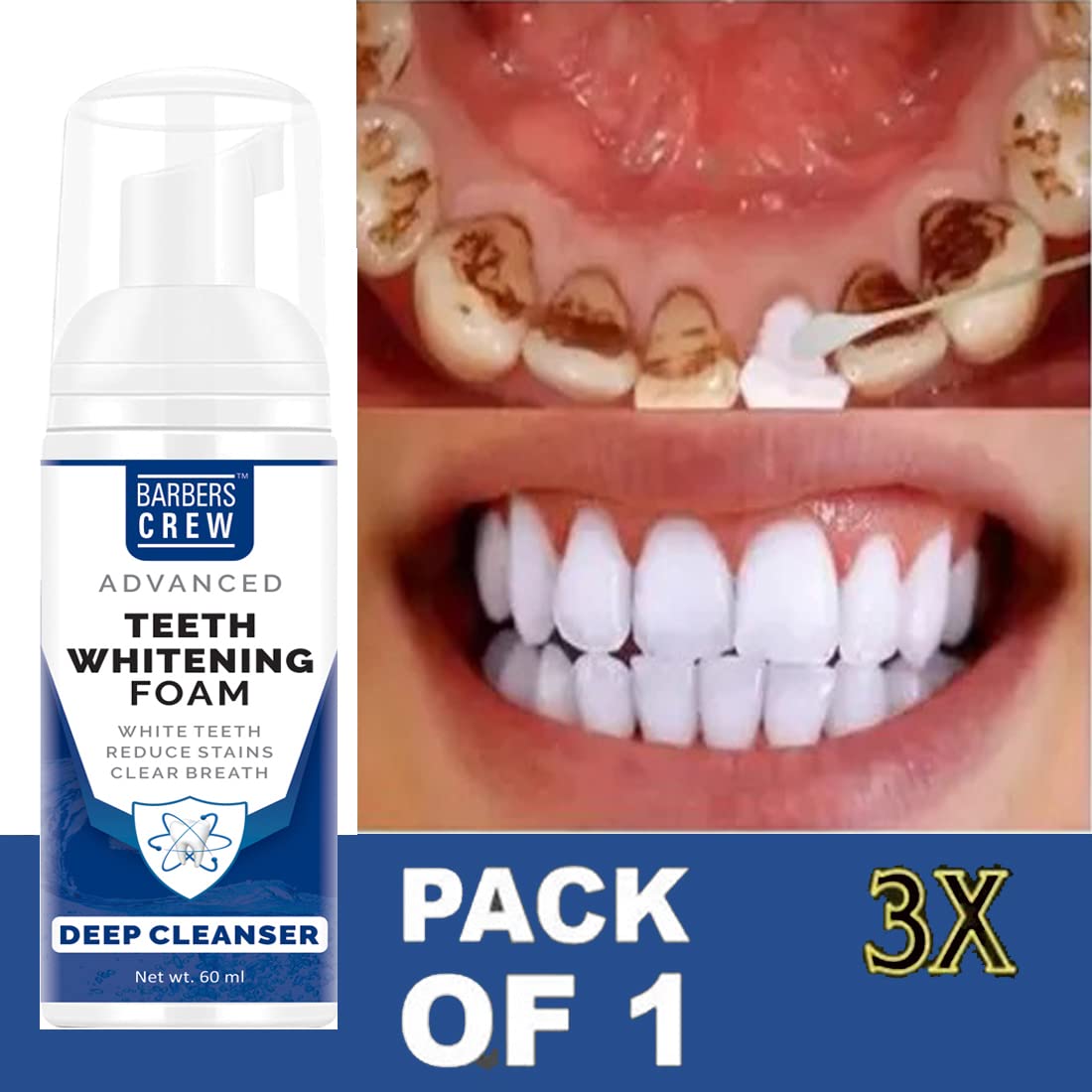 Barbers Crew Teeth Cleansing Foam To Remove Yellow Stains Tartar and Tobacco Stains 60 ML 1