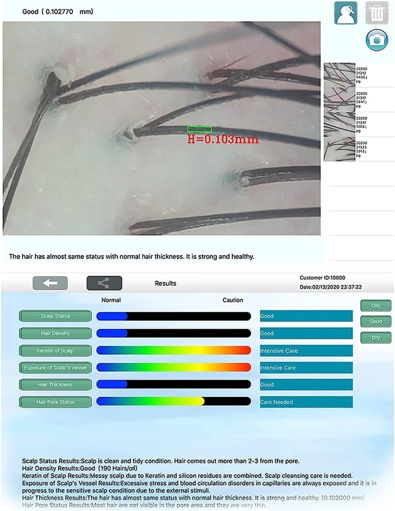 Analyseur de peau, détecteur intelligent for l'analyse des cheveux et du cuir chevelu de la peau et du cuir chevelu, dispositif d'analyse du cuir chevelu au microscope, analyseur facial fluorescent d'