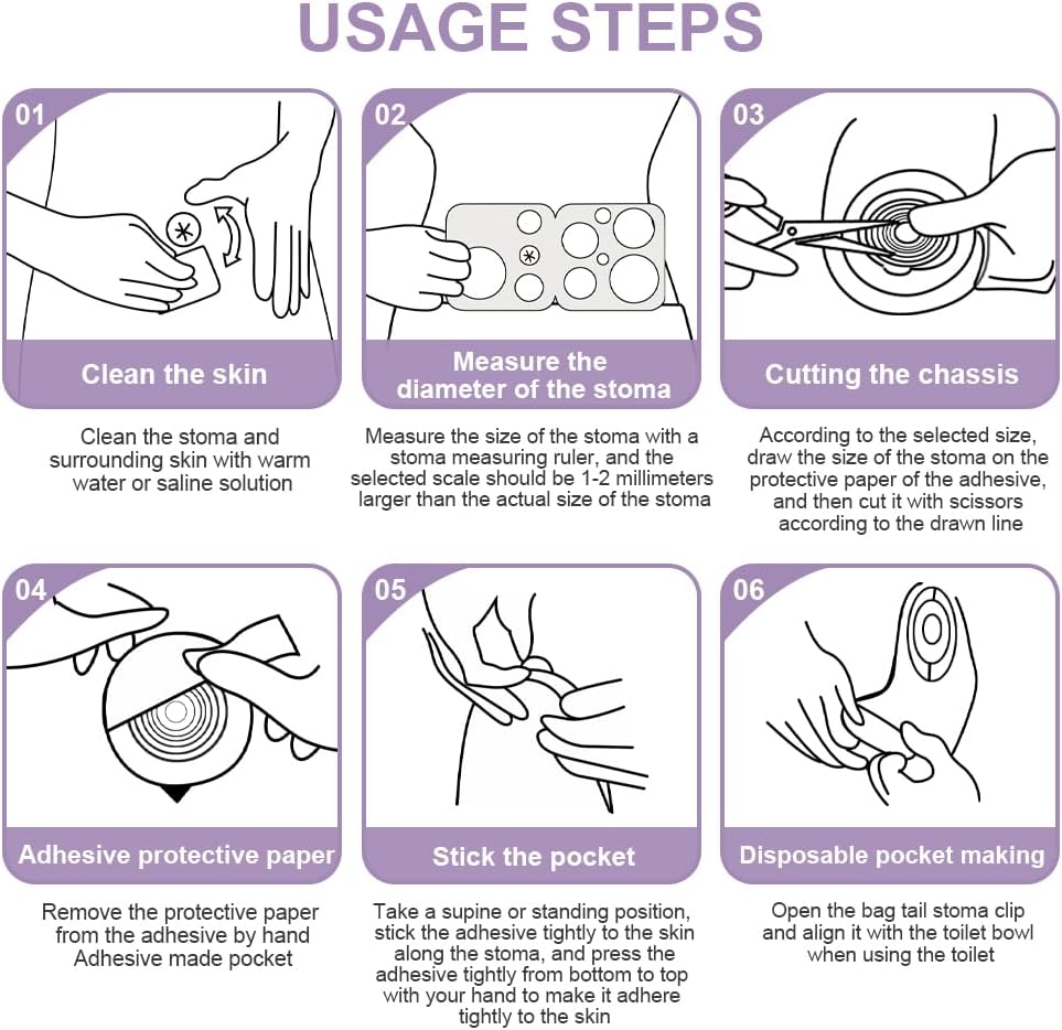 100 Pcs Colostomy Bags,20-65mm Ostomy Supplies, One-Piece Ostomy Bags for Lleostomy Stoma Care, Cut-to-Fit Non Woven Fabric Anti Swelling Bag Lock Design