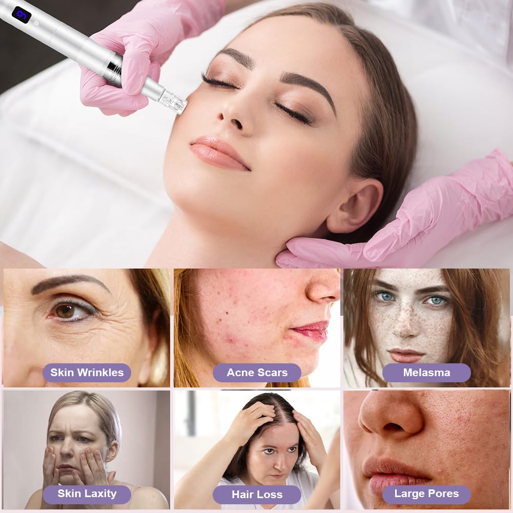 Vicloon Professional Wireless Microneedling Pen, Beauty Pen LCD Screen - Image 4