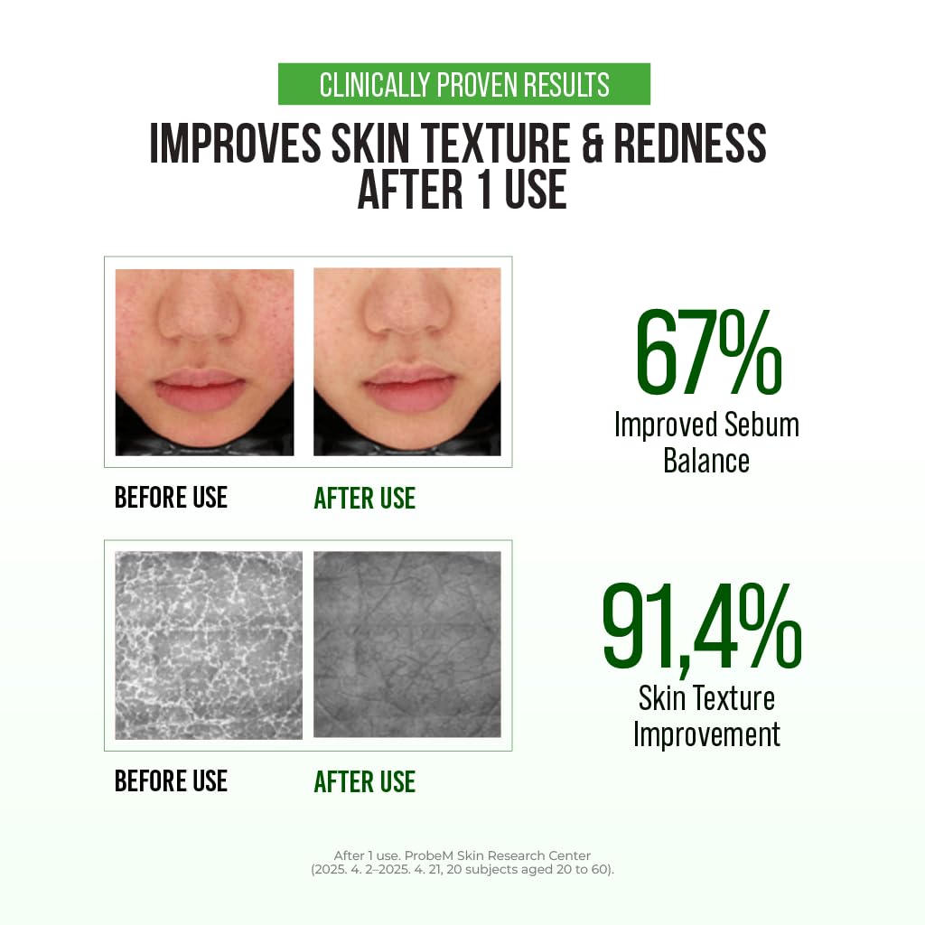 JUMISO D-Panthenol Barrier Soothing Serum (70ml/2.37oz) – Korean 10 Types Hyaluronic Acid Cooling Face Serum for Oily Acne Prone & Sensitive Skin, Centella Niacinamide Gentle BHA, Fragrance-Free - Image 6